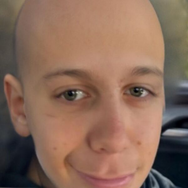 The Baldies|Nathan Is Going Bald The Baldies|Nathan Is Going Bald