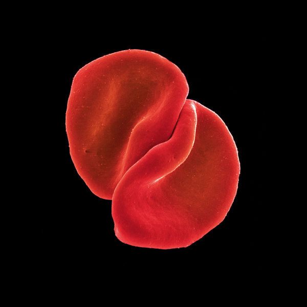 Peter Gabriel|Scratch My Back (Special Edition) Peter Gabriel|Scratch My Back (Special Edition)